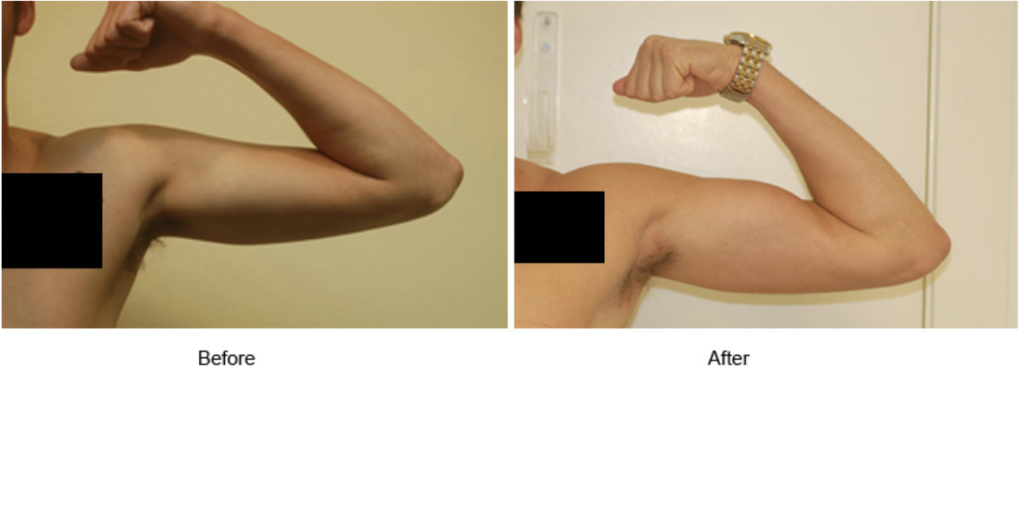 What Sets a Top San Francisco Plastic Surgery Center Apart?